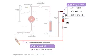 旁必福Parsabiv再訪 - 實際施打的經驗分享